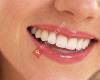Elegant Smiles Dental South Perth