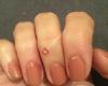 Oz Nails