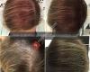 Scalp Micropigmentation Center Queensland