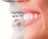 The Look Orthodontics - Keilor Downs